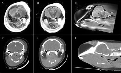 Postmortem Neuroimaging of Cetacean Brains Using Computed Tomography and Magnetic Resonance Imaging